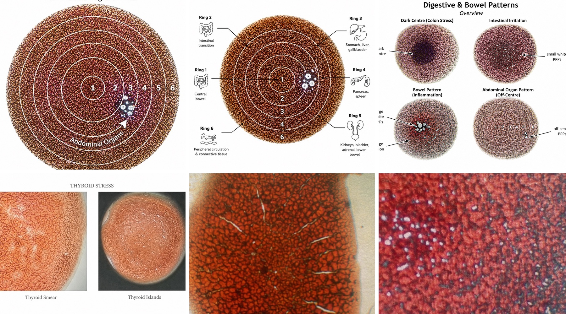 Dried Blood Analysis showing blood patterns, rings and terrain areas examined during the workshop